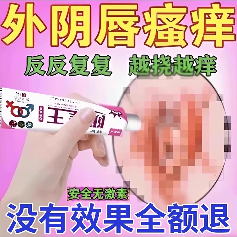 顽选灵私处止痒抑菌乳膏15g
