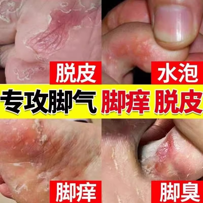 【嘉效】盐酸特比萘芬乳膏1%*20g*1支/盒