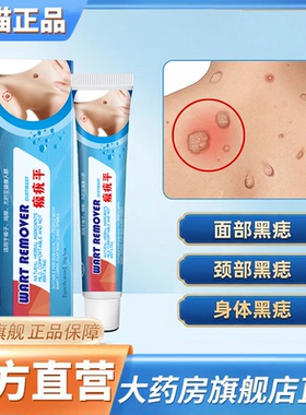 瘊疣平官方旗舰店正品肉刺鸡眼瘊子外用乳膏植物草本萃取3CL