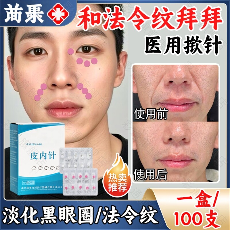 男士揿针医用同款中医无菌法令纹
