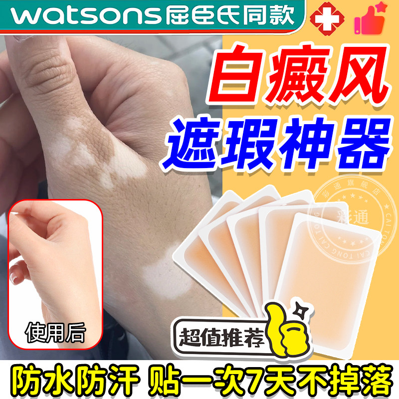 【持久遮瑕】白癜风遮瑕神器夏季
