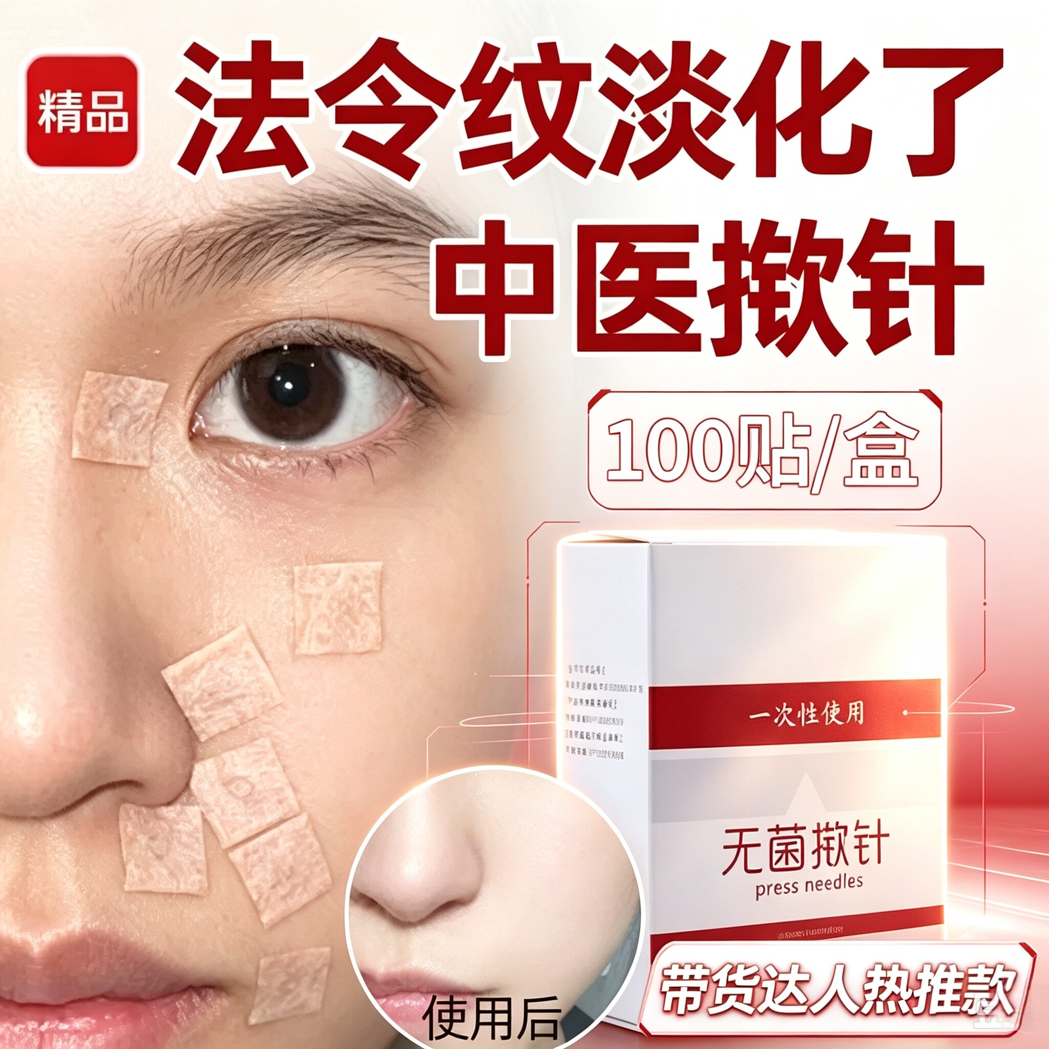 【中医同款】揿针穴位贴法令纹