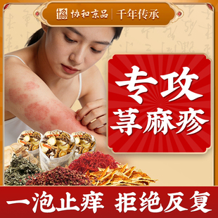 荨麻疹非中药泡澡的泡脚包慢性提高免疫力寻过敏风团性止痒断非根