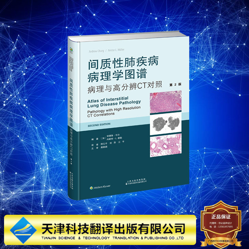 正版全新 间质性肺疾病病理学图谱病理与高分辨CT对照 第2版 〔加〕安德鲁·许尔等 天津科技翻译出版社 9787543344143