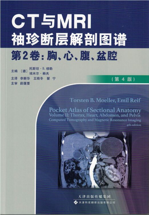 现货 CT与MRI袖珍断层解剖图谱第2卷:胸、心、腹、盆、腔李新华王晓冬翟宁主译天津科技翻译出版社