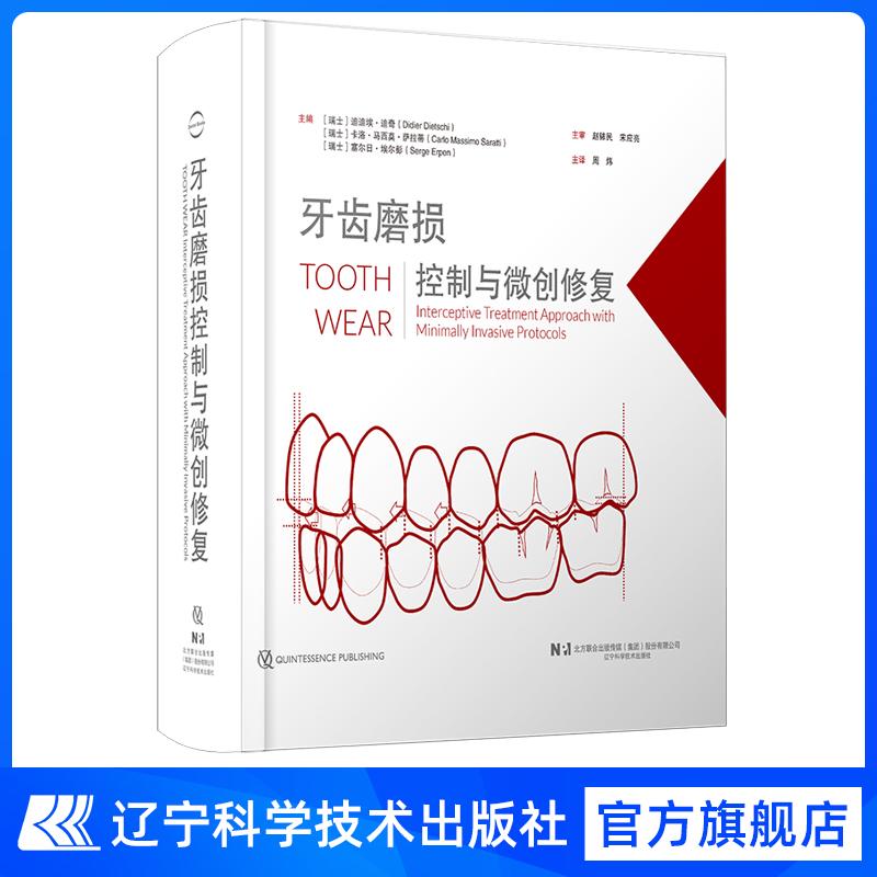 牙齿磨损控制与微创修 周炜译 迪迪埃·迪奇 卡洛·马西莫·萨拉蒂 塞尔日·埃尔彭 精装 辽宁科学技术出版社9787559145840