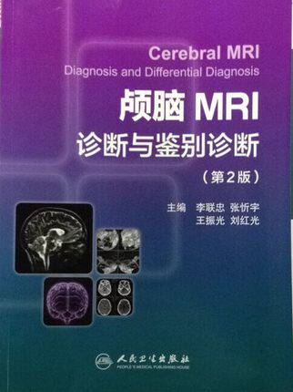 颅脑MRI诊断与鉴别诊断（第2版）  李联忠,张忻宇 等主编 人民卫生出版社 图文