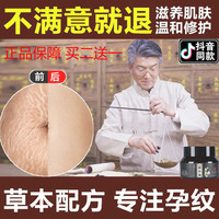 祛祛抗妊娠纹修复霜预防孕妇专用产后淡护理紧致油神器妊辰纹正品