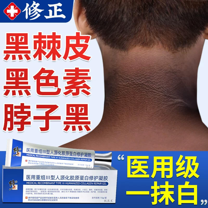 脖子黑色素去除黑棘皮症病去黑色素沉淀药膏神器洗不干净儿童正品