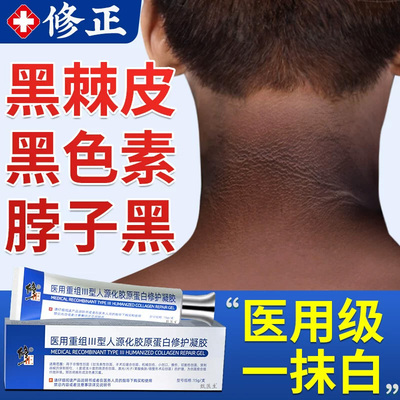 脖子黑色素去除黑棘皮症病去黑色素沉淀药膏神器洗不干净儿童正品