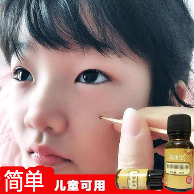 frtfrt脸部黑点雀斑痦子
