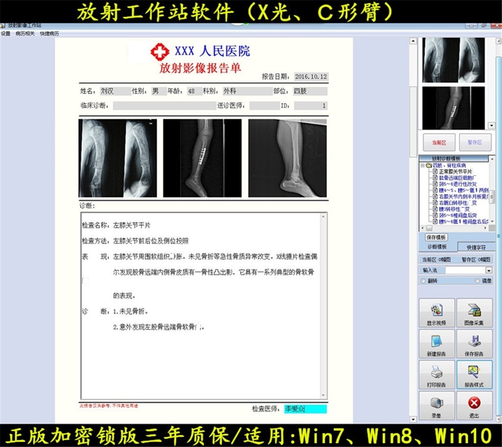 放射X光工作站软件C形臂影像图文系统正版加狗锁版包邮