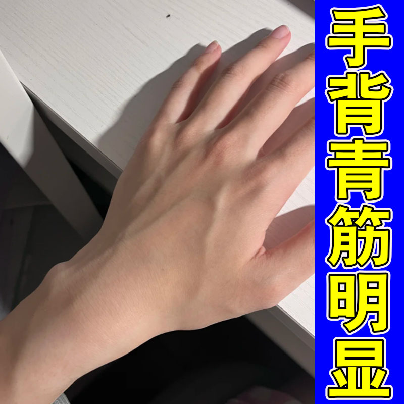 手背上青筋皮肤血管凸起青筋扩张凸起手上血管弯修护乳膏