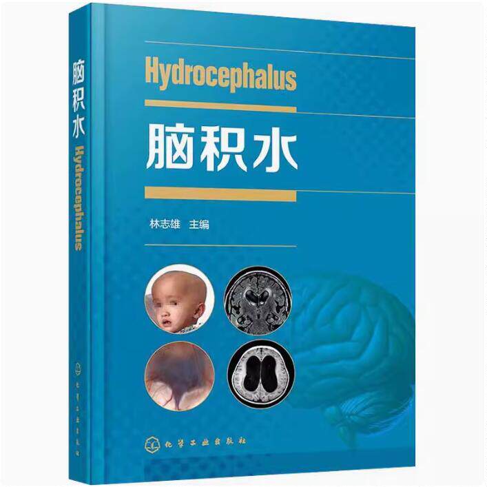 正版包邮 脑积水 林志雄 主编 显微外科神经内镜神经外科学脑血管脑外科颅脑损伤书籍手术 化学工业出版社 9787122370945