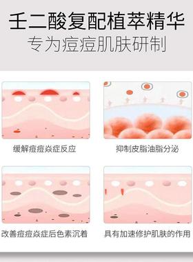 15 cyborgade condensate creams, fine pox desalinization seal