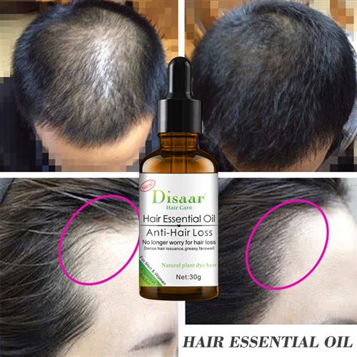 Plant Hair Essential Oil Anti Loss Serum Growth Promoting油