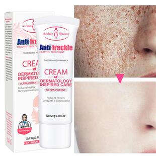 Whitening Freckle Cream Remove Dark Spots Melanin Melasma Br