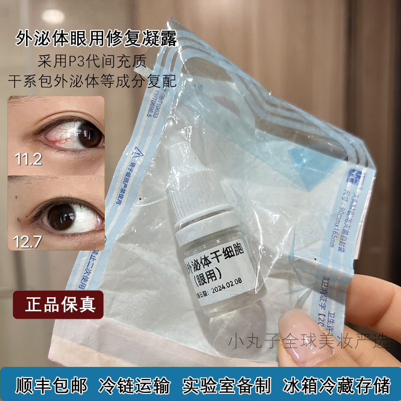 外泌体修护凝露眼药水缓解眼睛疲劳发黄红血丝浑浊5ml 眼干涩