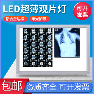 超薄X光观片灯箱医用led看片灯箱阅片灯三联看观片灯双联骨科核磁