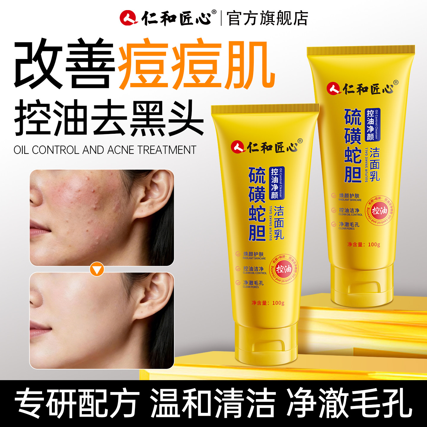商超同款丨热销100W硫磺洁面乳图片
