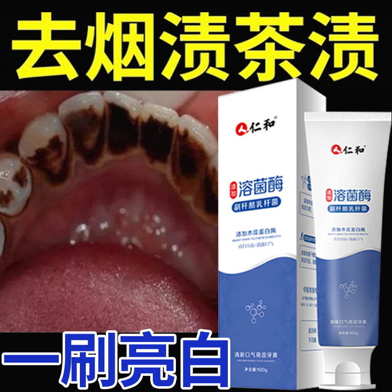 匠心仁和去烟渍牙膏美白去黄去口臭官方旗舰店正品排行榜第一名