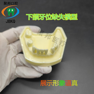 牙齿模型口腔教学模型假牙模型缺失牙科模型下颌模型下牙少牙模型