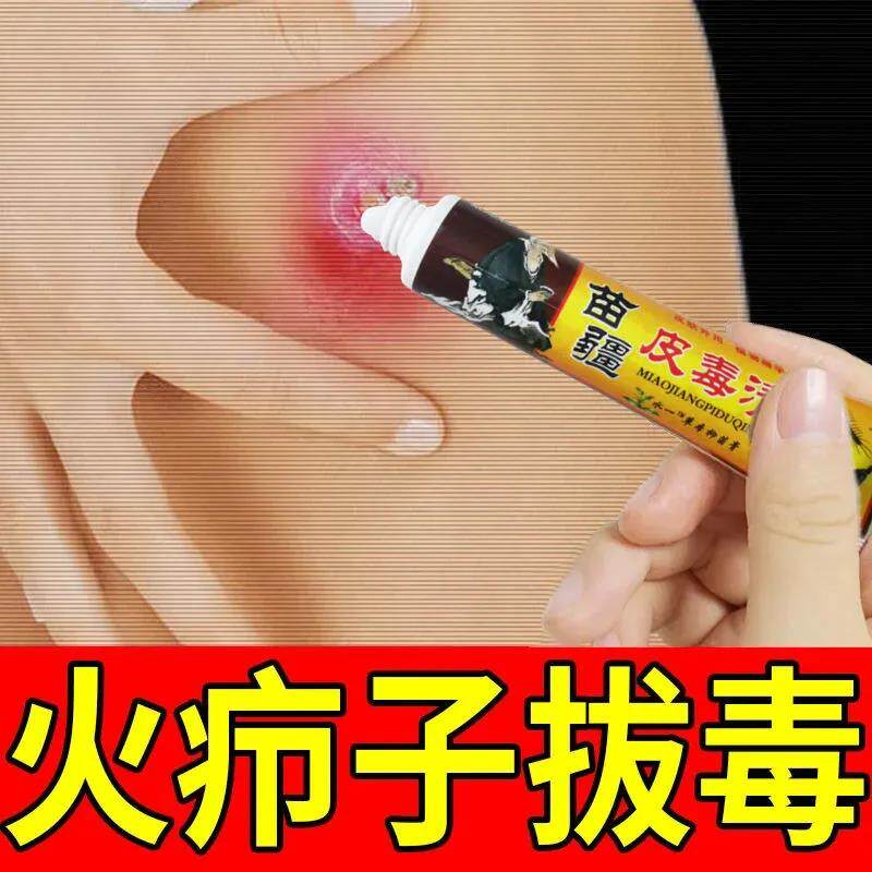 疖子拔脓神器~三天出脓！