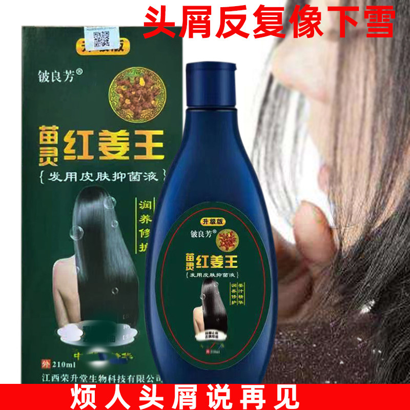 铍良芳野生红姜王祛屑止痒洗发水控油防脱除螨头屑头藓头皮屑痒清