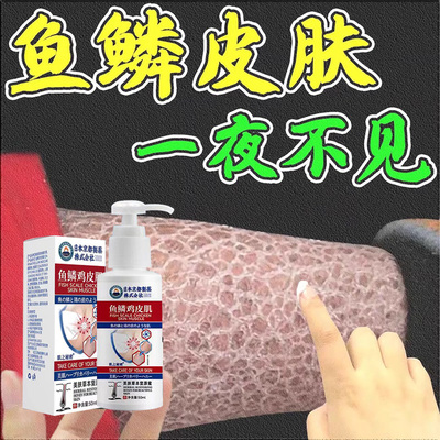 秋季皮肤干燥痒起皮病冬