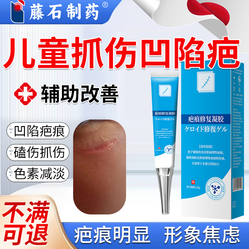 儿童指甲抓伤凹陷性疤痕膏痘坑凝胶贴小孩男女生长因子摔伤手术VT