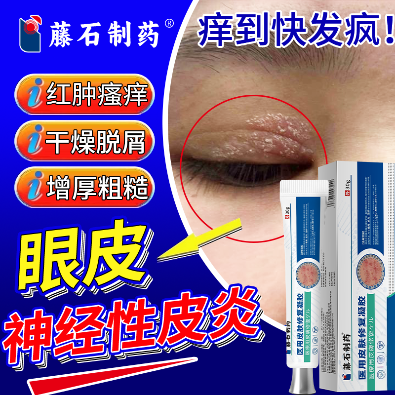 神经性皮炎眼皮癣膏眼睛周围眼角痒干燥起皮掉屑红肿痒药监备案PG