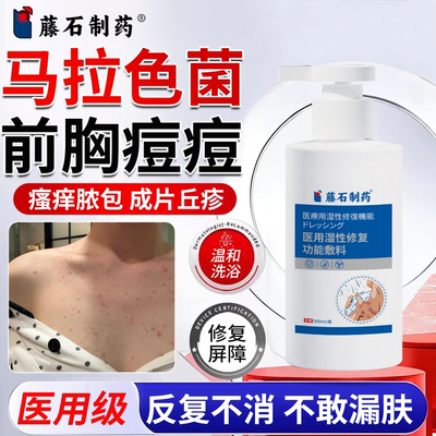 马拉色菌毛囊炎沐浴露去除胸口前胸后背痘痘痤疮疙瘩祛痘PG