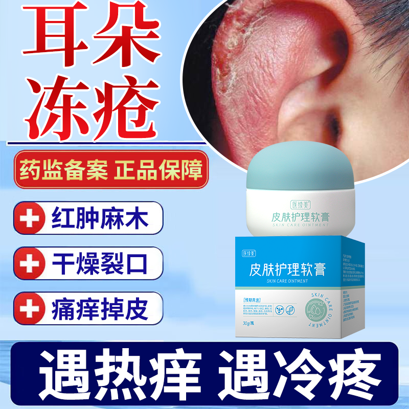 耳朵冻疮特膏止痒冻伤膏效药监备案防裂冻手足儿童PG