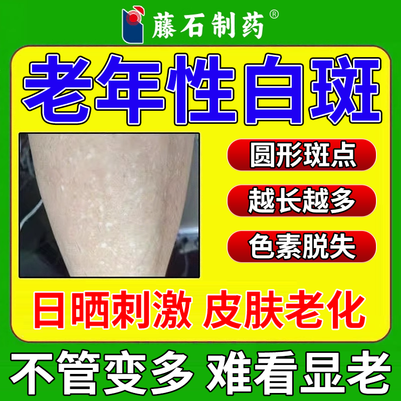 老年性白斑膏圆形白点胳膊老年斑黄褐斑手背白斑肤色药监备案PG