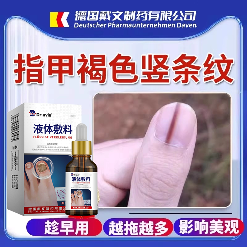 指甲有黑线长褐色竖纹有甲母痣竖条纹灰指甲护理医用药监备案PG