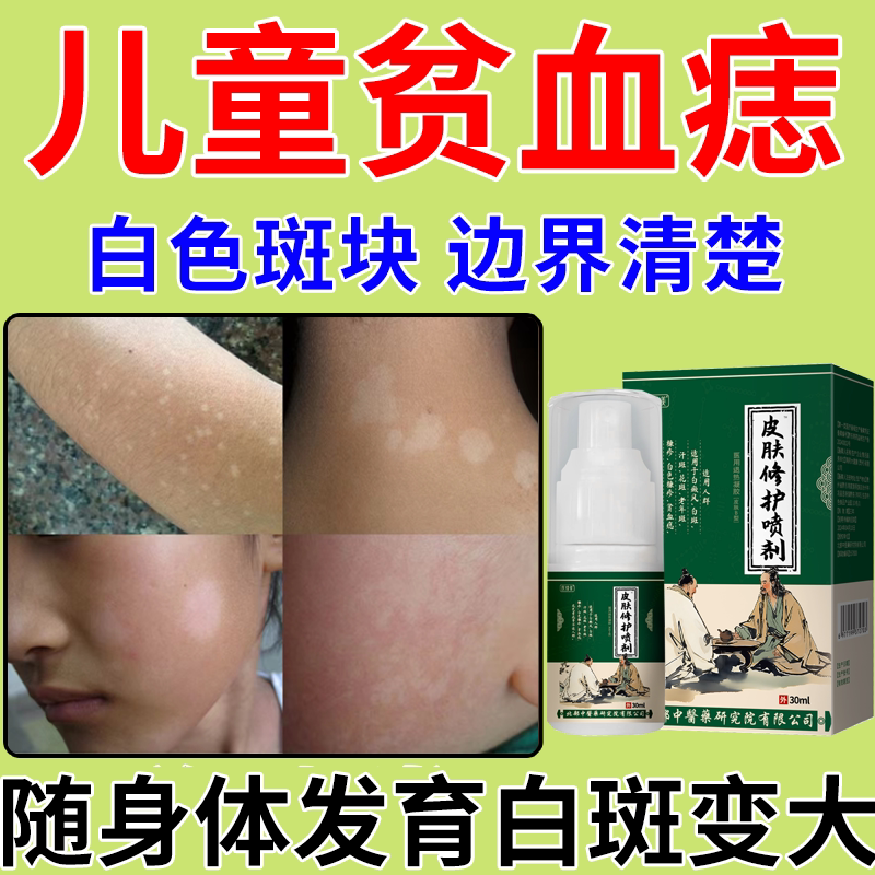 儿童贫血痣脸上长白斑身上起白斑专小孩用白色糠疹可搭膏药贴膏pg