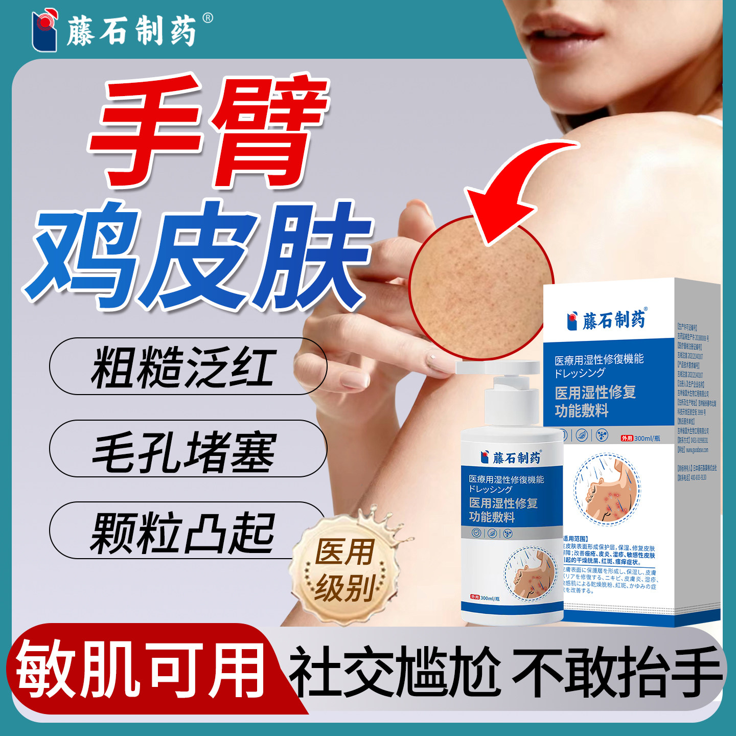 手臂鸡皮肤疙瘩毛囊炎药刷酸遮干燥痒瑕去全身手臂腿除沐浴露JI