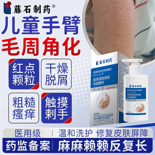儿童手臂胳膊毛周角化鸡皮肤面部起小疙瘩干燥痒保湿沐浴露PG