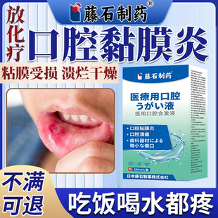 放化疗口腔黏膜炎药监备案溃疡干燥漱口水口舌生疮疼痛含漱液PG