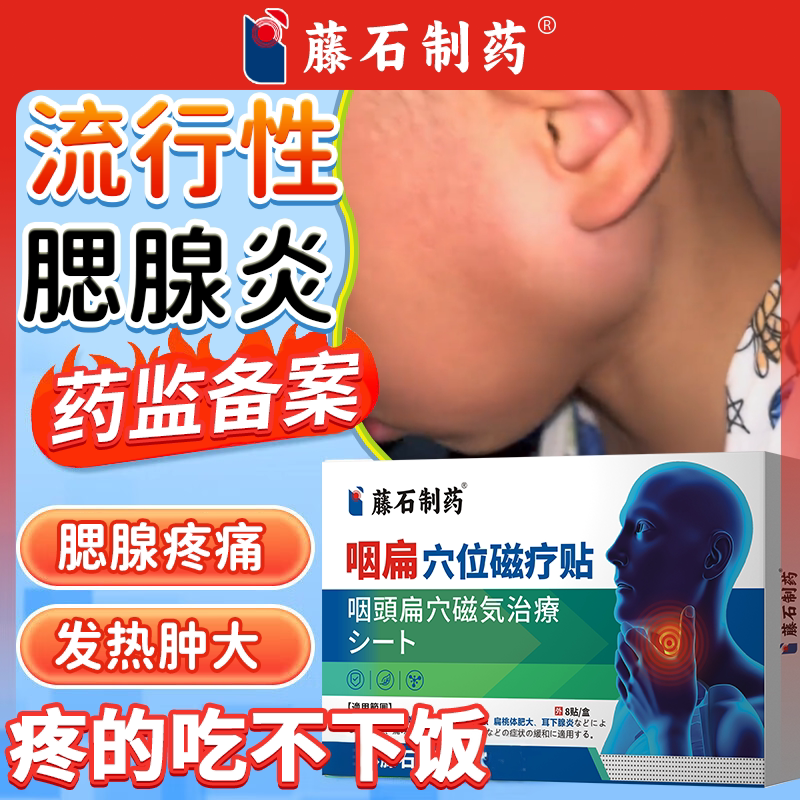 流行性腮腺炎腮腺肿大痄腮膏贴疼痛肿痛药监备案PG