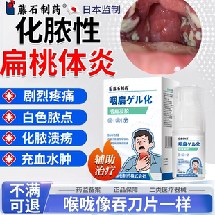 性化脓性扁桃体炎发炎药监备案喷雾喷剂白色脓点咽喉咙肿痛溃疡PG