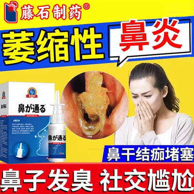 萎缩性鼻炎鼻腔干燥出血结痂有臭味鼻塞通鼻喷雾剂PG