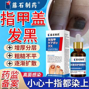 指甲盖发黑真菌感染灰指甲坏甲淤血发黑痣甲母痣黑线药监备案PG