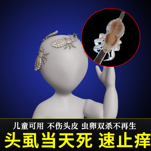 头虱子药虫卵双杀小女孩头上长虱子的药除头虱专用药虱立净去除xf
