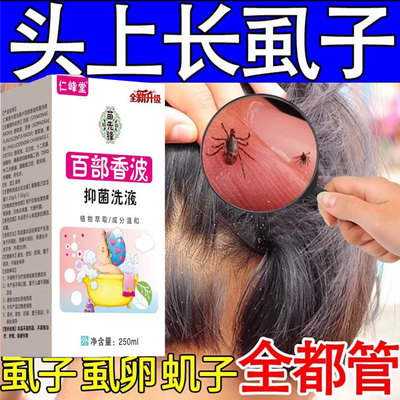 虱子药小女孩头发去除虱卵双杀虱立净头上有虱子百部酊洗发水儿童