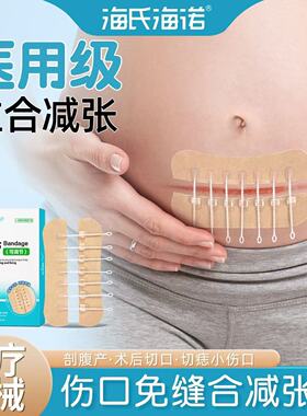 减张贴减张器绷带医用皮肤剖腹产术后儿童小伤口拉合胶布