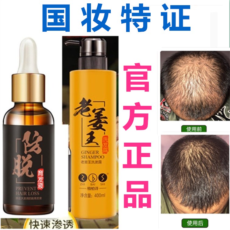 正品草本植柏诗头发增长液生长育发液+老姜王2件套防脱发头发精油