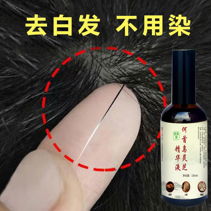 正品乔芙丽何首乌草本育发液防脱免洗精华液洗发水