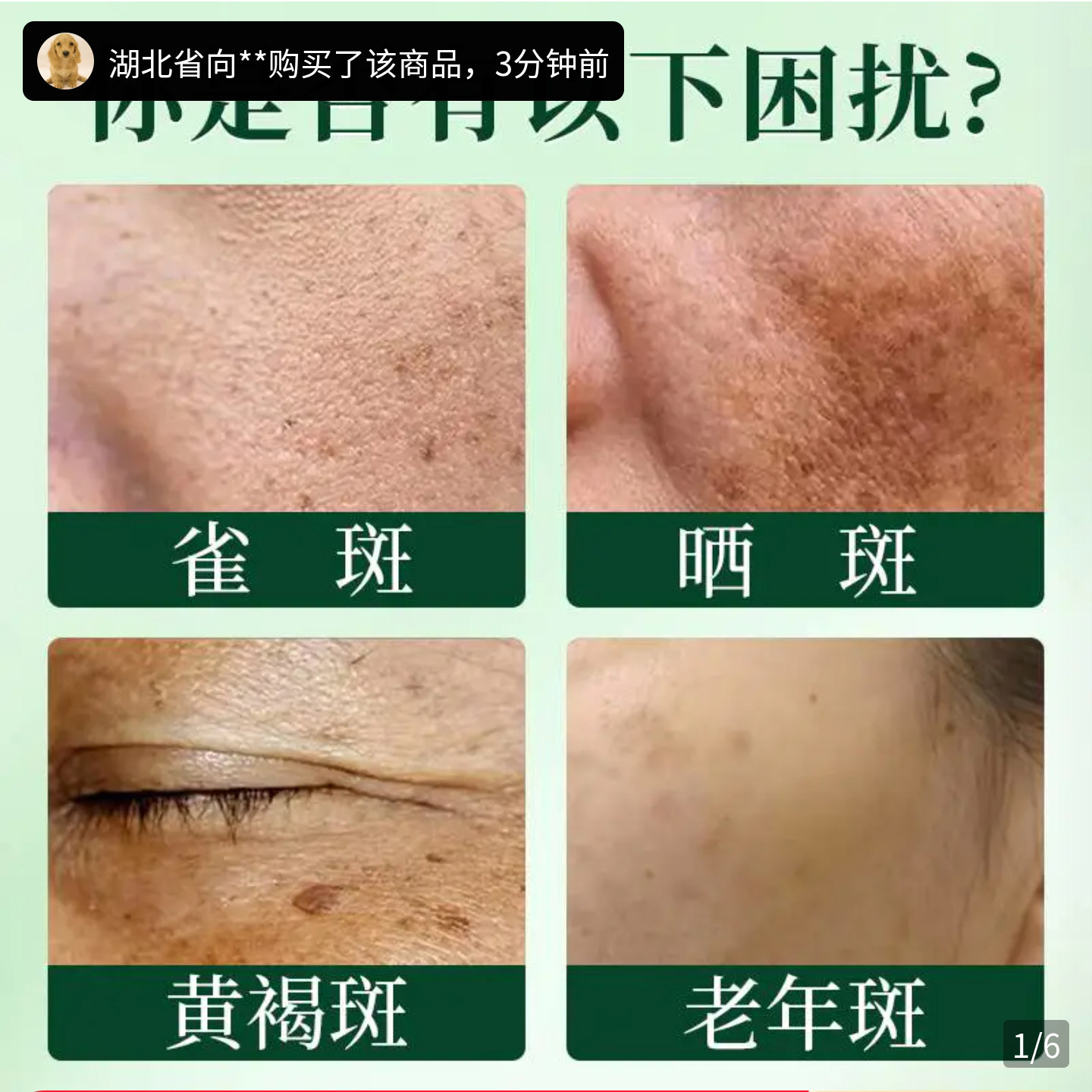 377古法祛斑水官方正品碧泉之花老国货美白淡斑精华水去斑点喷雾