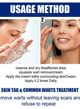 EELHOE Skin Care Cream, a topical application for skin clean